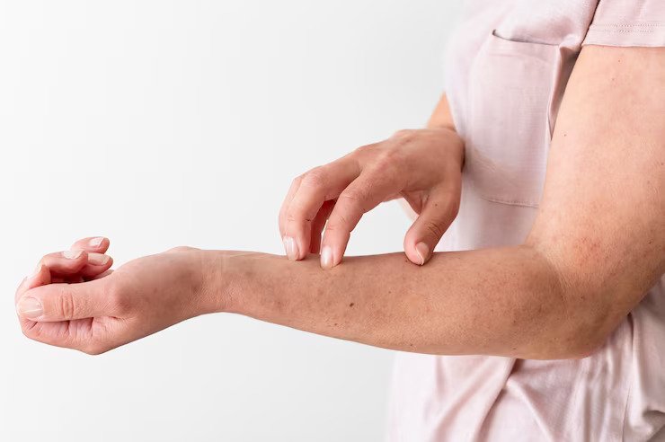 Коварство гиповитаминоза – в неприметности